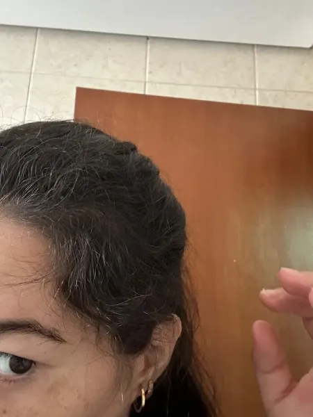 MediCapilar Tricologia Clínica
